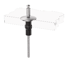 Push Button Quick Release Toilet Seat Kit with Fixed Base and Rubber Expansion Top Fixing