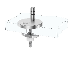 Adjustable Quick-Release Toilet Seat Mounting Kit with Pull-Out Base and Boat-Type Top Lock